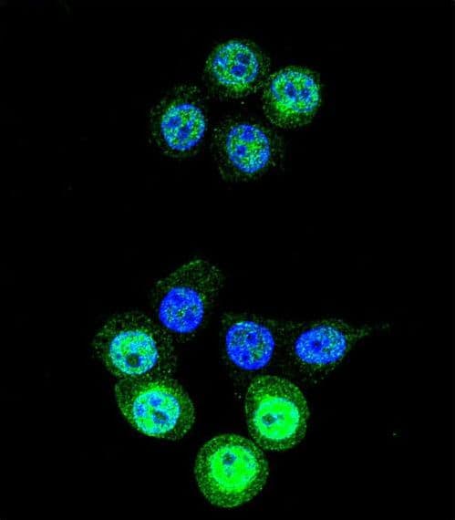 AKR1B1 / Aldose Reductase Antibody (aa290-316)