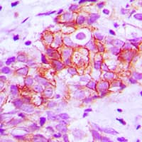 PathPlus™ CDH1 / E Cadherin Antibody (C-Terminus)