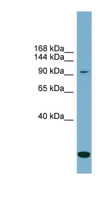 Polyclonal Rabbit anti-Human SLC12A4 / KCC1 Antibody (N-Terminus, WB)