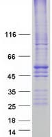 Human SLC16A1 / MCT1 Protein (Recombinant Myc-DDK (Flag))