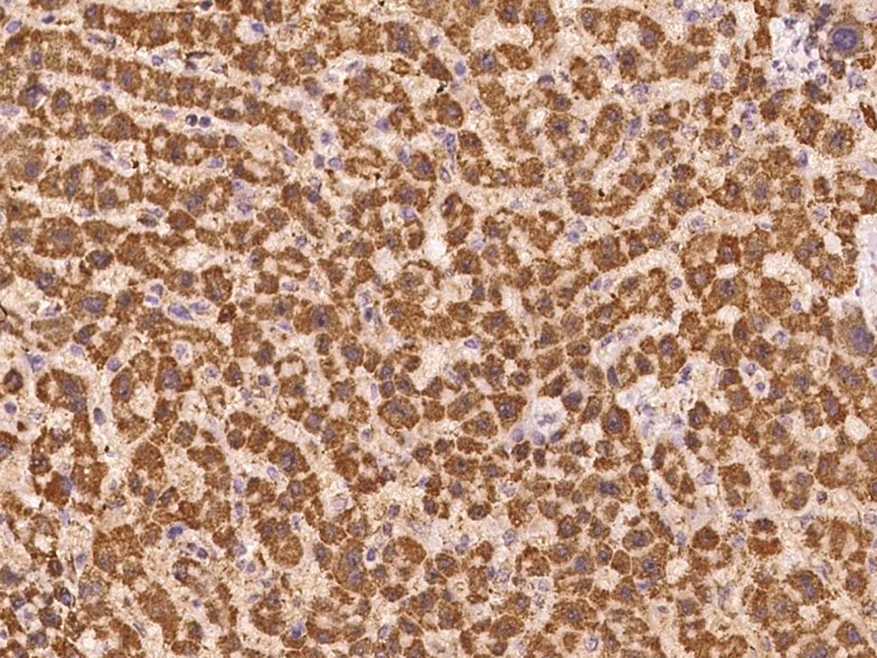 SLU7 / 9G8 Antibody