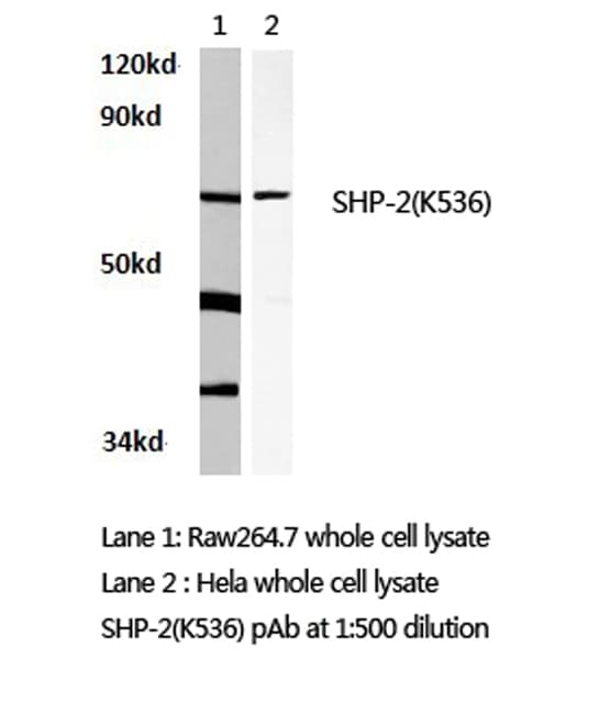 Polyclonal Rabbit anti-Human PTPN11 / SHP-2 / NS1 Antibody (Lys536, IHC, WB)