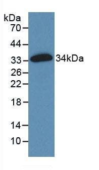 Human FN1 / Fibronectin Protein (Recombinant His, N-Terminal)