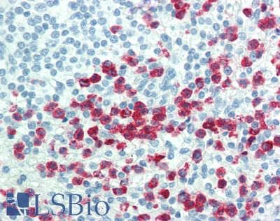 IHC-plus™ Monoclonal Mouse anti-Human FCN1 / Ficolin-1 Antibody (aa95-314, IHC)