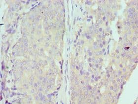 MCM7 Antibody (aa360-719)