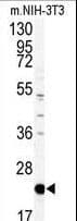 PEBP1 / RKIP Antibody (aa137-167)