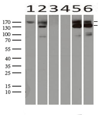 Monoclonal Mouse anti-Human c-Met Antibody (clone UMAB190, Carrier-free, aa570-885, IHC, IF, WB)