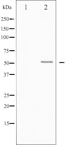 Vitamin D Receptor / VDR Antibody (phospho-Ser208)