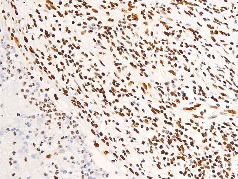 NR3C1/Glucocorticoid Receptor Antibody (phospho-Ser203)