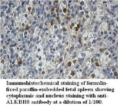 ALKBH8 Antibody (aa2-238)