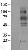 Human SLC6A4 / SERT Protein (Over-Expression Lysate Myc-DDK (Flag))