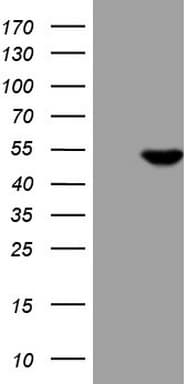 Monoclonal Mouse anti-Human PDIA6 / ERP5 Antibody (clone OTI8C2, WB)