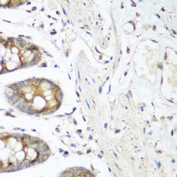 FLT4 / VEGFR3 Antibody