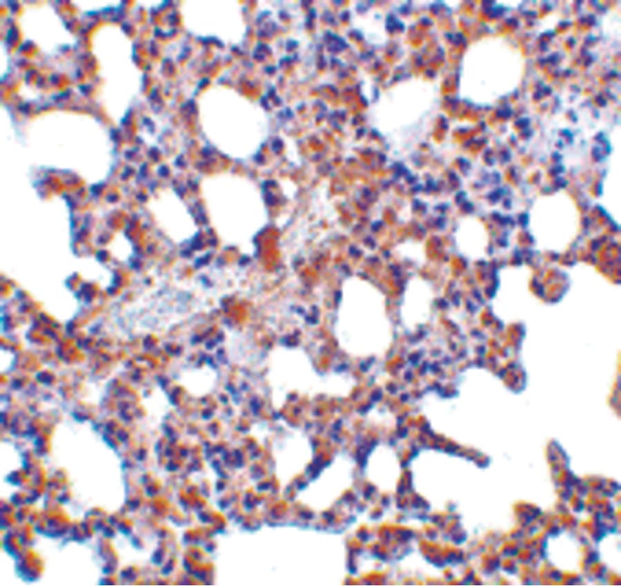 Polyclonal Rabbit anti-Human BLIMP1 / PRDM1 Antibody (IHC, WB)