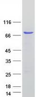 Human CDK5RAP3 Protein (Recombinant Myc-DDK (Flag))