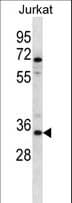 Polyclonal Rabbit anti-Human OR2G3 Antibody (aa245-272, WB)