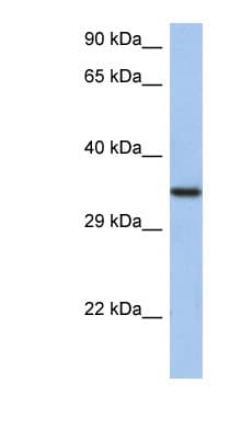 HORMAD2 Antibody (aa35-84)