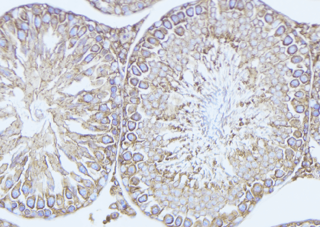 ODF2 Antibody