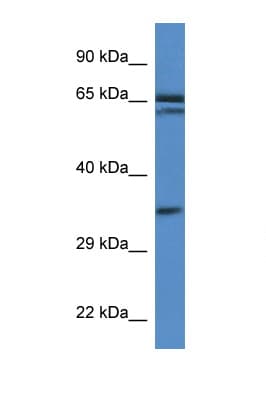 TERF2IP / RAP1 Antibody (aa142-191)