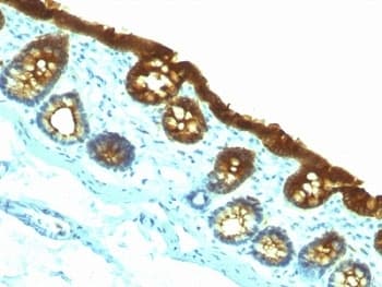 KRT19 / CK19 / Cytokeratin 19 Antibody (clone KRT19/800)