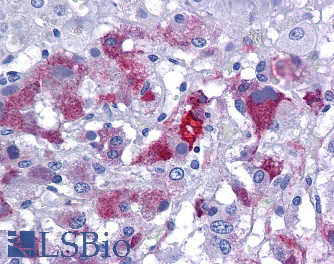 IHC-plus™ Polyclonal Rabbit anti-Human FOXO4 / AFX1 Antibody (IHC, IF, WB)
