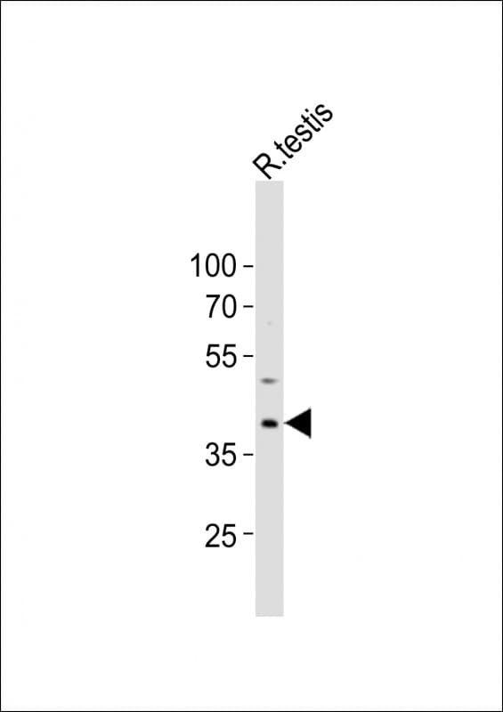 PCGF6 Antibody (aa215-249)