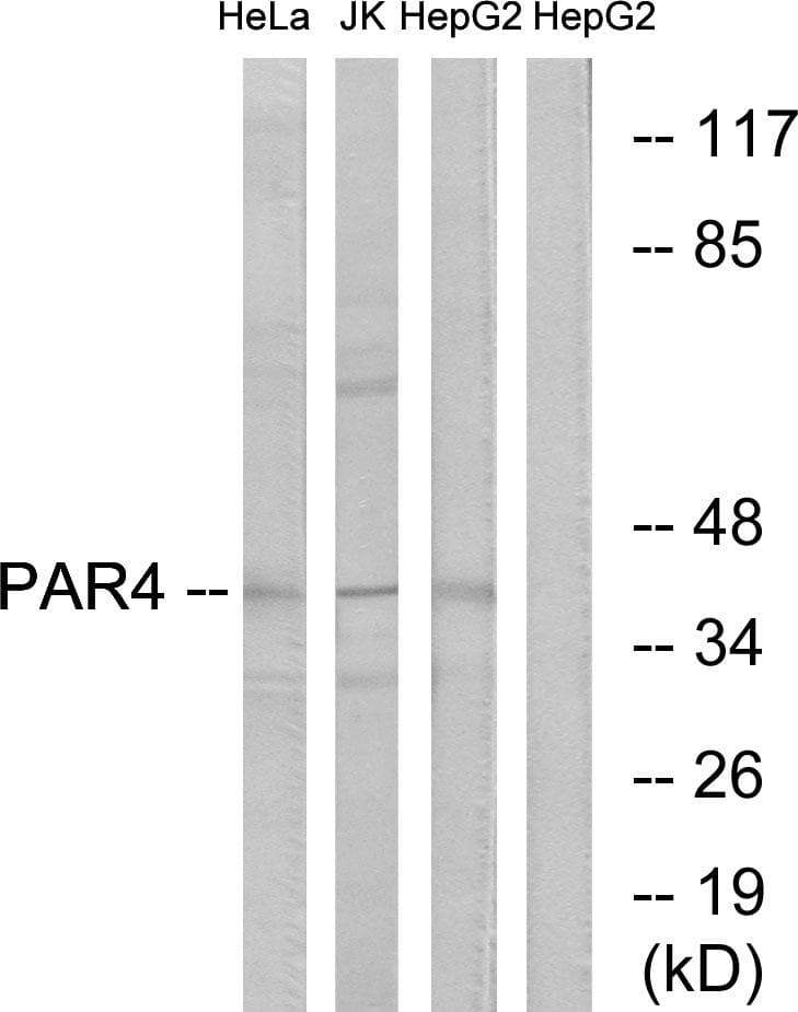 Polyclonal Rabbit anti-Human F2RL3 / PAR4 Antibody (IF, WB)