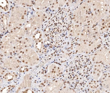 Polyclonal Rabbit anti-Human STMN1 / Stathmin / LAG Antibody (phospho-Ser15, IHC, IF, WB)
