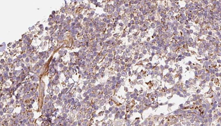 Polyclonal Rabbit anti-Human DEFB121 Antibody (IHC, IF, WB)