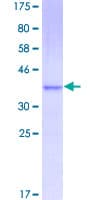Human CCL11 / Eotaxin Protein (Recombinant GST)