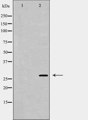 U2AF1 Antibody