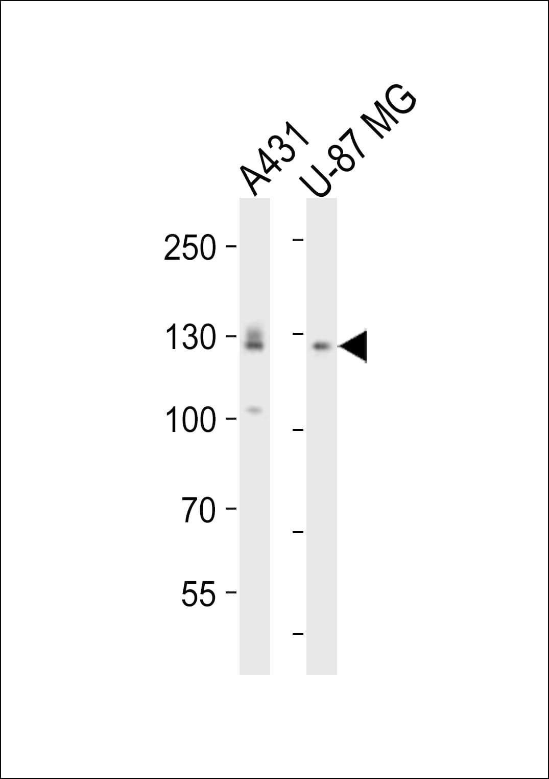 EPHA2 / EPH Receptor A2 Antibody (aa518-552)