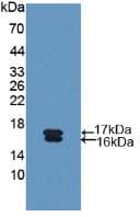 Glycocalicin Antibody (aa136-276)