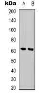 Polyclonal Rabbit anti-Human PHF1 Antibody (Internal, IHC, WB)