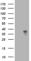 NUDT9 Antibody (clone OTI7A12)