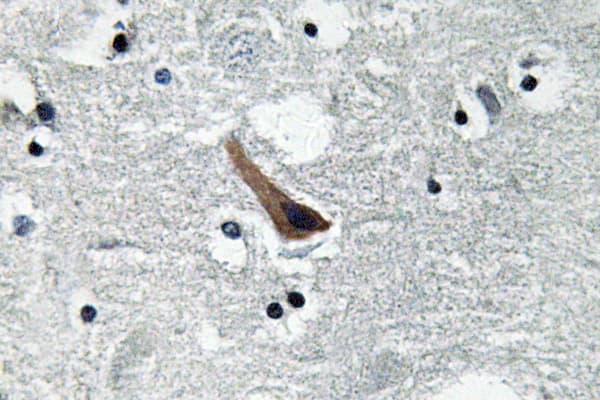 GABRA1 Antibody (aa312-361)