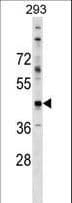 Polyclonal Rabbit anti-Human CADM2 Antibody (aa50-76, WB)