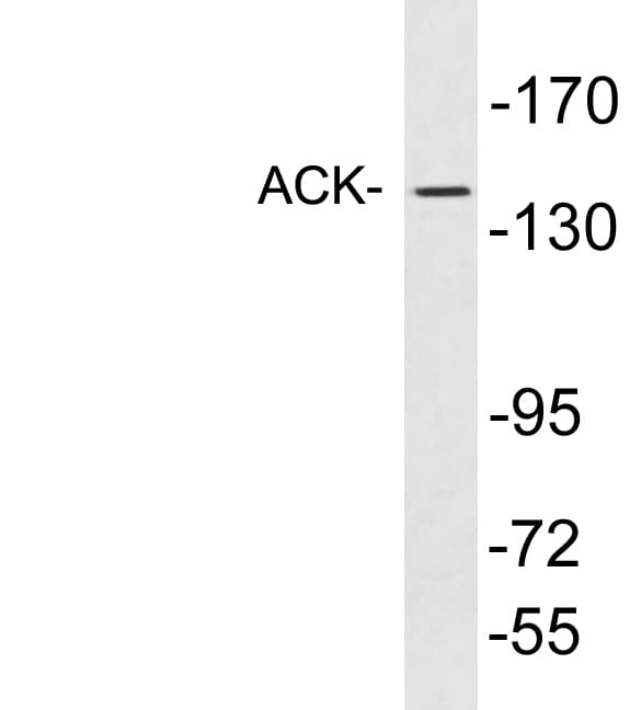 TNK2 / ACK1 Antibody (aa466-515)