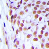LIG1 / DNA Ligase 1 Antibody (N-Terminus)