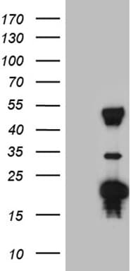 TYW2 / TRMT12 Antibody (clone OTI1C9)