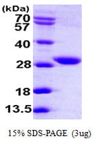 Human FVT1 / KDSR Protein (Recombinant His)