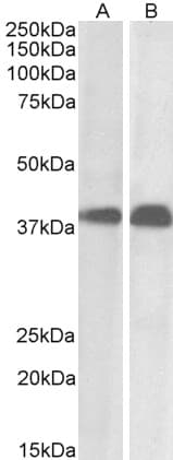 IHC-plus™ SET / TAF-I Antibody (aa2-15)