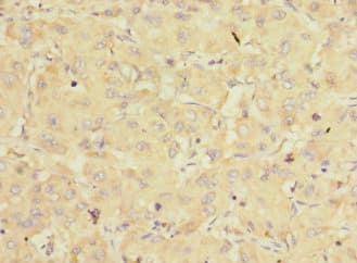 EIF3K Antibody