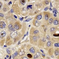 DISC1 Antibody