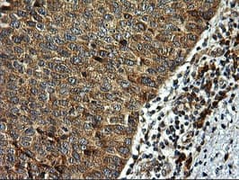 RGS16 Antibody (clone OTI1D3)