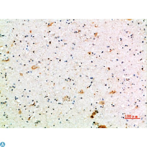 FCGR1A / CD64 Antibody