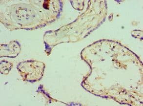 Polyclonal Rabbit anti-Human KCNN4 / KCa3.1 Antibody (aa288-427, IHC)