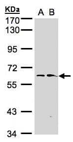 Polyclonal Rabbit anti-Human FMO1 Antibody (aa1-437, WB)