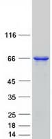 Human OPTN / Optineurin Protein (Recombinant Myc-DDK (Flag))