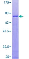 Human CKMT1B Protein (Recombinant GST)